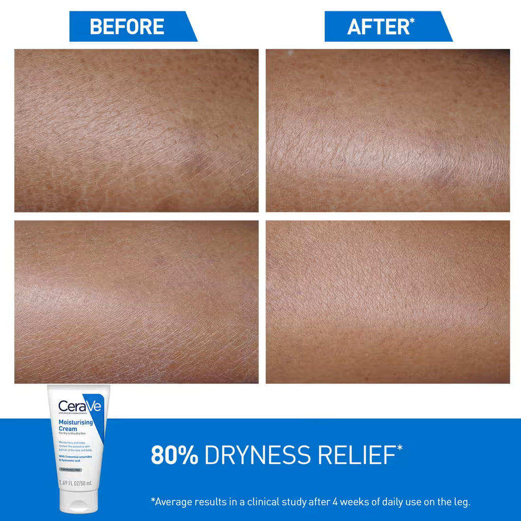 CeraVe Moisturizer Cream For Dry Skin & Barrier Repair (454 g)