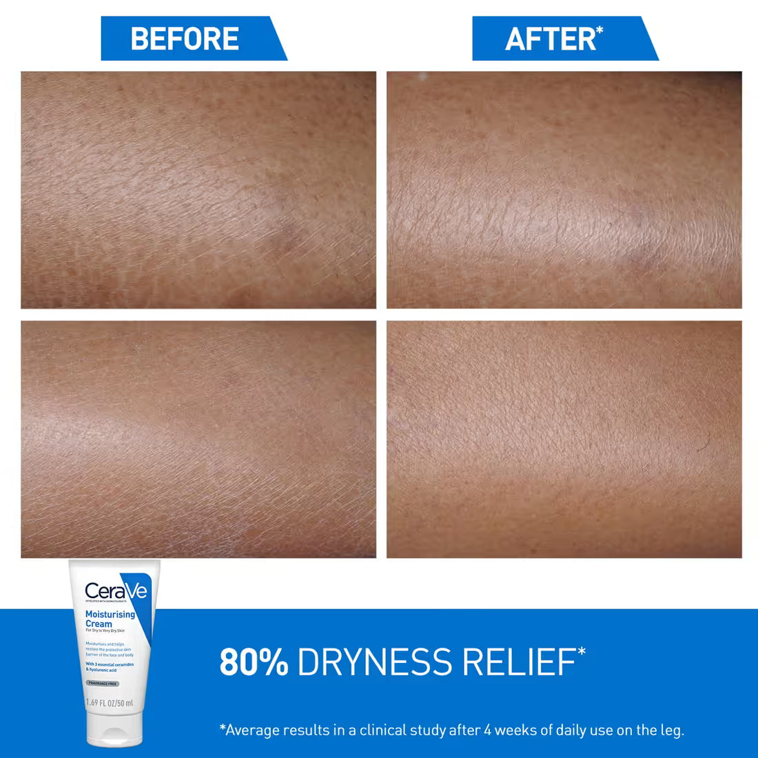 CeraVe Moisturizer Cream For Dry Skin & Barrier Repair (454 g)